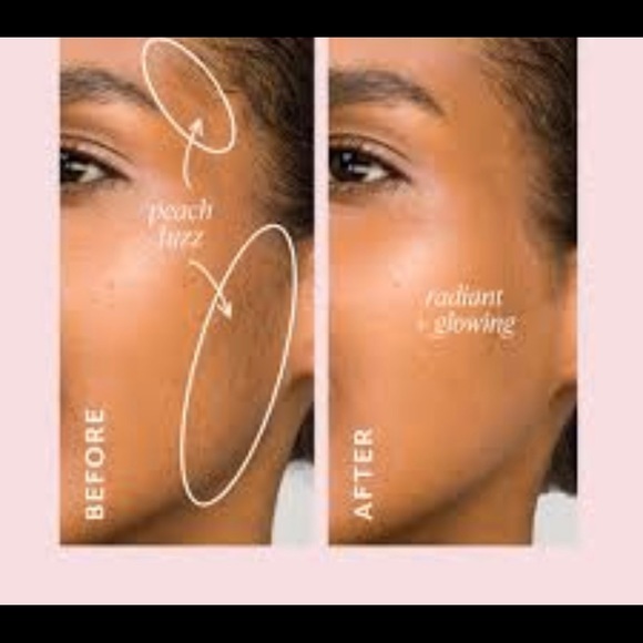 DERMAFLASH Complete Exfoliation Kit - Picture 5 of 14